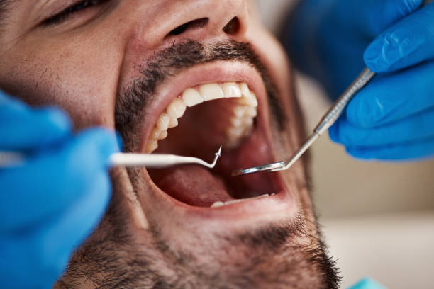 Best Emergency Dental Care for Broken or Chipped Teeth in Bountiful, UT