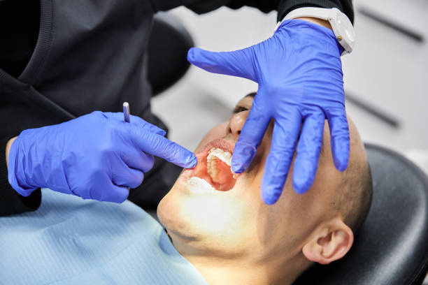 Best Emergency Wisdom Teeth Removal in Bountiful, UT