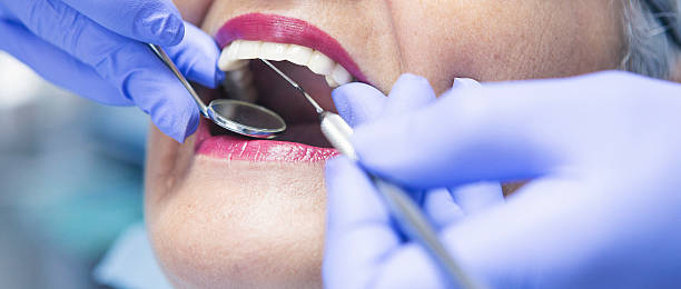 Best Emergency Denture Repair in Bountiful, UT